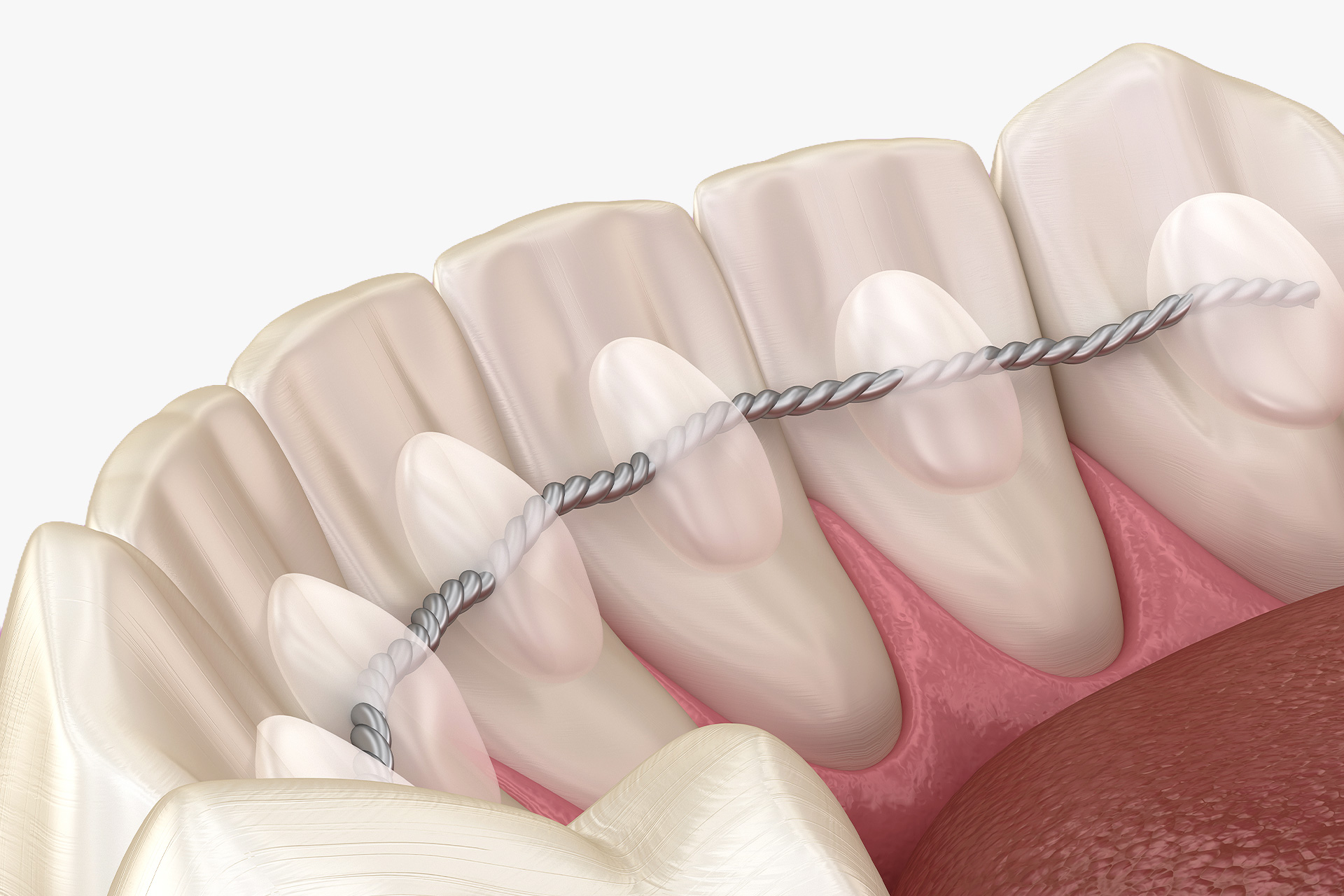 Retention phase: Secure result! Hanover & Burgwedel