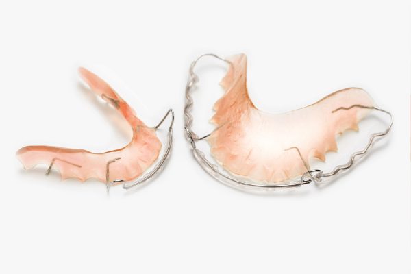 Loose braces